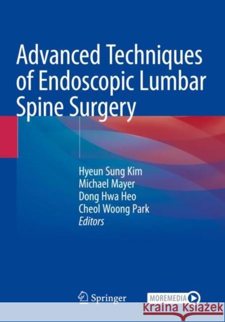 Advanced Techniques of Endoscopic Lumbar Spine Surgery  9789811582554 Springer Singapore