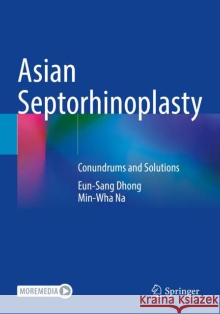 Asian Septorhinoplasty: Conundrums and Solutions Dhong, Eun-Sang 9789811605444 Springer Nature Singapore
