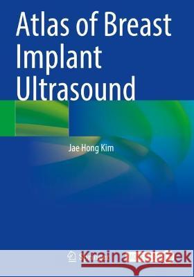 Atlas of Breast Implant Ultrasound Jae Hong Kim 9789811682841 Springer Nature Singapore