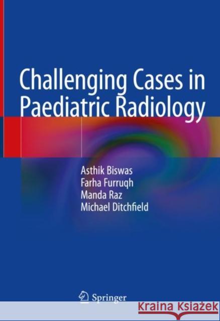 Challenging Cases in Paediatric Radiology Asthik Biswas Farha Furruqh Manda Raz 9789811959622 Springer