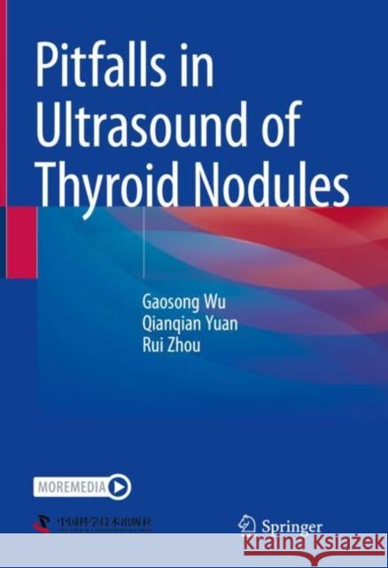 Pitfalls in Ultrasound of Thyroid Nodules Gaosong Wu Qianqian Yuan Rui Zhou 9789811988721 Springer