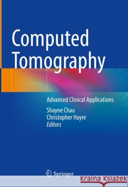 Computed Tomography: Advanced Clinical Applications Shayne Chau Christopher Hayre 9789811993459