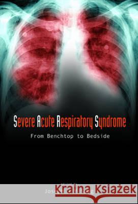 Severe Acute Respiratory Syndrome (Sars): From Benchtop to Bedside Joseph J. Y. Sung 9789812387530 World Scientific Publishing Company