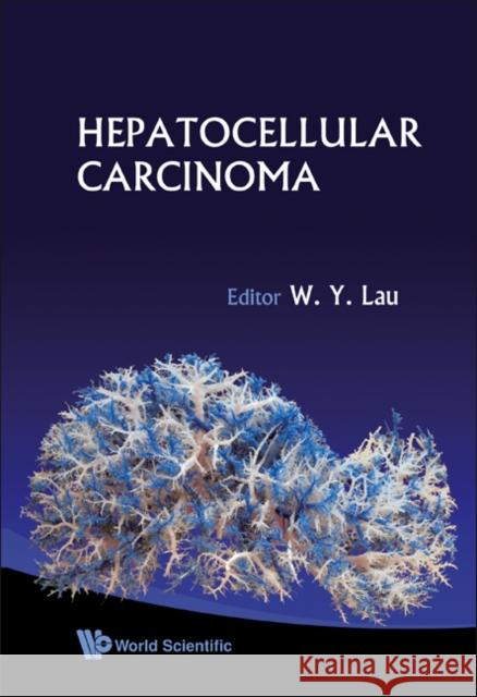 Hepatocellular Carcinoma W. y. Lau 9789812707994 World Scientific Publishing Company