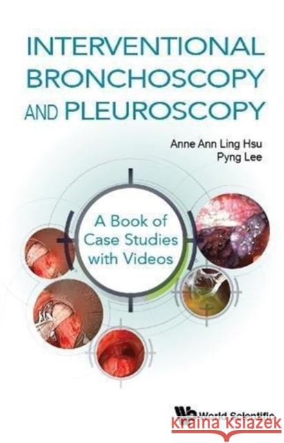 Interventional Bronchoscopy and Pleuroscopy: A Book of Case Studies with Videos Hsu Anne Ann Ling, Lee Pyng 9789813229006 World Scientific (ML)