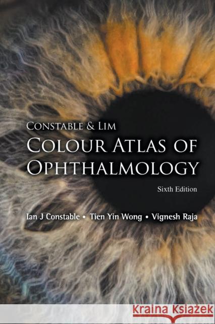 Constable & Lim Colour Atlas of Ophthalmology (Sixth Edition) Constable, Ian J. 9789813237292 World Scientific Publishing Company