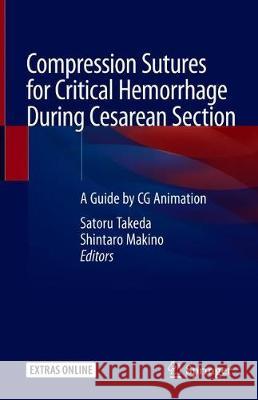 Compression Sutures for Critical Hemorrhage During Cesarean Section: A Guide by CG Animation Takeda, Satoru 9789813294592 Springer