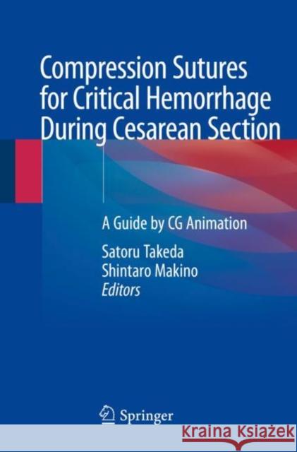 Compression Sutures for Critical Hemorrhage During Cesarean Section: A Guide by CG Animation Satoru Takeda Shintaro Makino 9789813294622 Springer