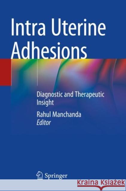 Intra Uterine Adhesions: Diagnostic and Therapeutic Insight Manchanda, Rahul 9789813341470