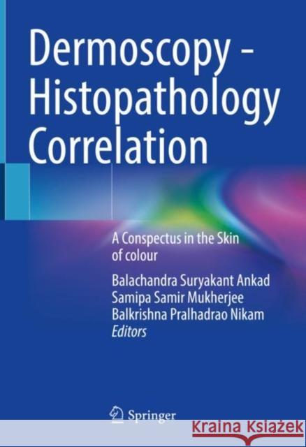 Dermoscopy - Histopathology Correlation: A Conspectus in the Skin of Colour Balachandra Suryakant Ankad Samipa Samir Mukherjee Balakrishna Pralhadrao Nikam 9789813346376 Springer