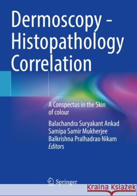 Dermoscopy - Histopathology Correlation   9789813346406 Springer Nature Singapore