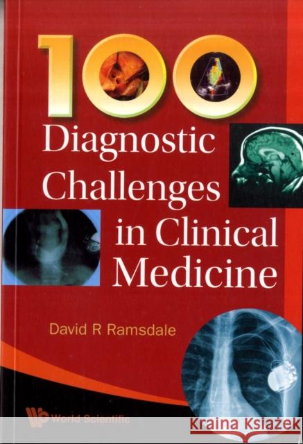 100 Diagnostic Challenges in Clinical Medicine Ramsdale, David R. 9789814271745 0