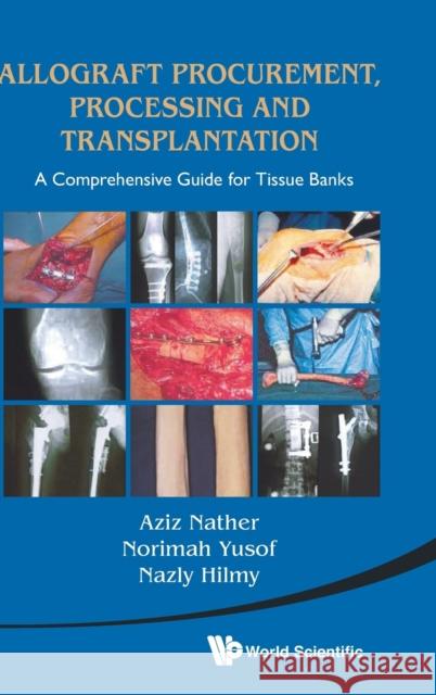 Allograft Procurement, Processing and Transplantation: A Comprehensive Guide for Tissue Banks Nather, Abdul Aziz 9789814291187 World Scientific Publishing Company