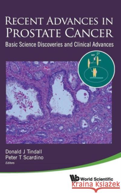 Recent Advances in Prostate Cancer: Basic Science Discoveries and Clinical Advances Tindall, Donald J. 9789814329453 World Scientific Publishing Company