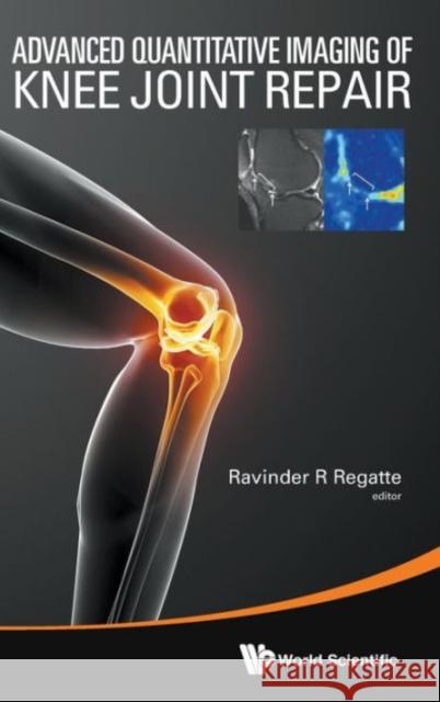 Advanced Quantitative Imaging of Knee Joint Repair Regatte, Ravinder R. 9789814579322 World Scientific Publishing Company