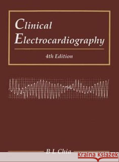 Clinical Electrocardiography (Fourth Edition) Boon Lock Chia B. L. Chia 9789814723268 World Scientific Publishing Company