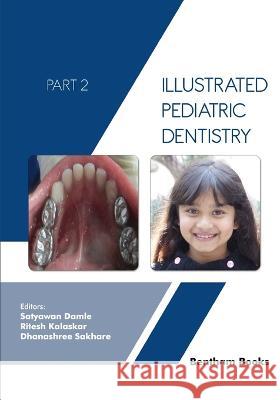 Illustrated Pediatric Dentistry - Part 2 Ritesh Kalaskar Dhanashree Sakhare Satyawan Damle 9789815080797 Bentham Science Publishers