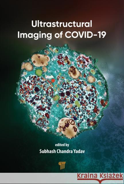 Ultrastructural Imaging of COVID-19 Subhash Chandra Yadav 9789815352009