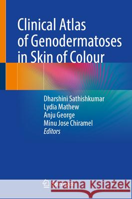 Clinical Atlas of Genodermatoses in Skin of Colour Dharshini Sathishkumar Lydia Mathew Anju George 9789819512799 Springer