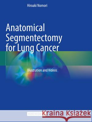 Anatomical Segmentectomy for Lung Cancer: Illustration and Videos Hiroaki Nomori 9789819958597 Springer