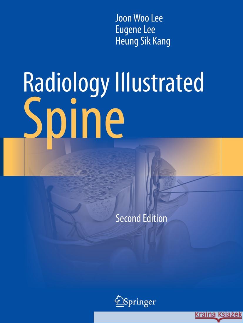 Radiology Illustrated: Spine Lee, Joon Woo, Eugene Lee, Heung Sik Kang 9789819966141