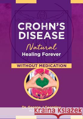 Crohn's Disease: Natural Healing Forever, Without Medication George John Georgiou 9789925569083 G.M.G. Da Vinci Health Ltd