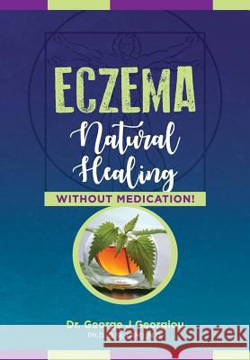 Eczema: Natural Healing, Without Medication George John Georgiou 9789925569229 G.M.G. Da Vinci Health Ltd