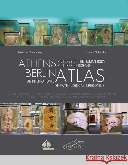 Athens Berlin: An International Atlas of Pathological Specimens: Pictures of the Human Body Pictures of Disease Nikolaos Kavantzas Thomas Schnalke 9789925575701