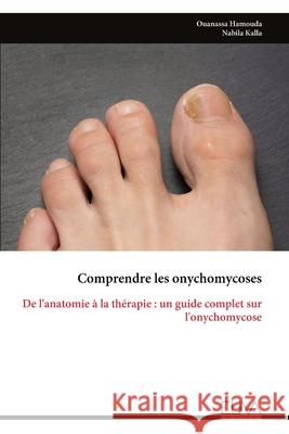 Comprendre les onychomycoses: De l'anatomie ? la th?rapie: un guide complet sur l'onychomycose Ouanassa Hamouda 9789999326292