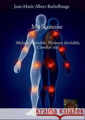 Ma Siamoise: Maladie invisible, Violence Invisible, Combat réel Albert Barberouge, Jean-Marie 9791042497460