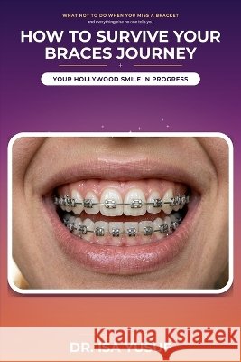 How to Survive Your Braces Journey: Your Hollywood Smiles on Progress Yusuf, Isa 9798191747132