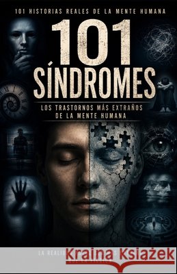 101 SÍNDROMES. Los Trastornos Más Extraños de la Mente Humana Fernández, Jesús 9798198563575