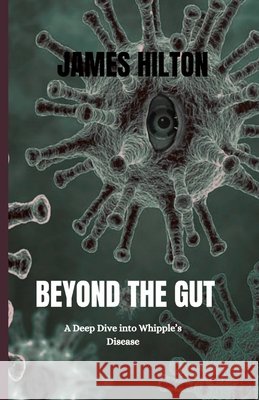 Beyond the Gut: A Deep Dive into Whipple's Disease Hilton, James 9798289863249 Independently Published