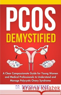 Pcos Demystified: A Clear Compassionate Guide for Young Women and Medical Professionals to Understand and Manage Polycystic Ovary Syndrome Kanfade, Dinesh 9798294829254