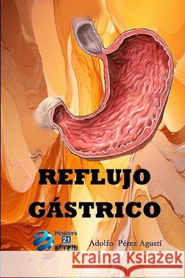 Reflujo gástrico Adolfo Pérez Agustí 9798334562158