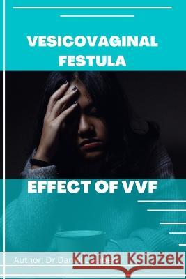 Vesicovaginal Fistula: Effect of Vvf Lambart, Daniel 9798357471642 Independently published