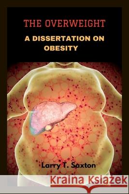 The Overweight: A Dissertation on Obesity Larry T Saxton   9798362177096 Independently Published