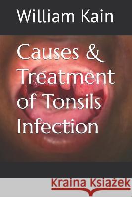 Causes & Treatment of Tonsils Infection William Kain   9798389983694 Independently Published