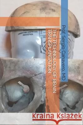 The Technology of Brain Transplantation Sergio Canavero 9798654837271