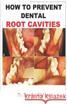 How to Prevent Dental Root Cavities Mahlare, Rantho 9798695406962 Independently Published