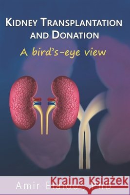 Kidney Transplantation and Donation: A Bird's-Eye View Elalouf, Amir 9798726636870 Independently Published