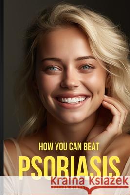 How You Can Beat Psoriasis: Quick Practical Remedies That Work Parham Donyai 9798859483853