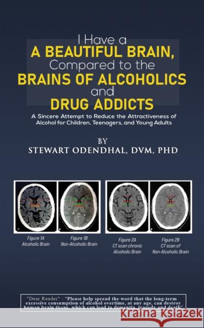 I Have a Beautiful Brain, Compared to the Brains of Alcoholics and Drug Addicts: A Sincere Attempt to Reduce the Attractiveness of Alcohol for Children, Teenagers, and Young Adults DVM, PhD, Stewart Odendhal 9798889109891 Austin Macauley Publishers LLC