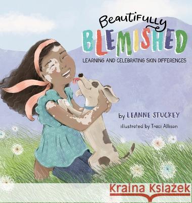 Beautifully Blemished: Learning and Celebrating Skin Differences Leanne Stuckey   9798985234510 Beautifully Blemished, LLC