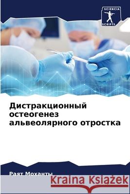 Дистракционный остеоге&# Моханm 9786204132945 Sciencia Scripts - książka