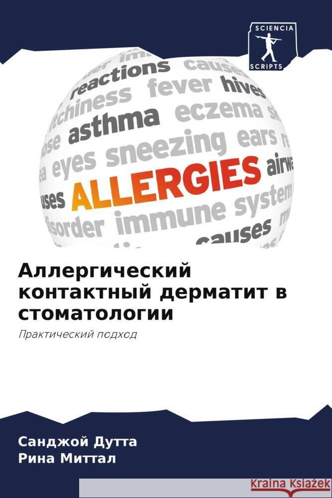 Аллергический контактн&#  Дутта Миттаl 9786205833483 Sciencia Scripts - książka