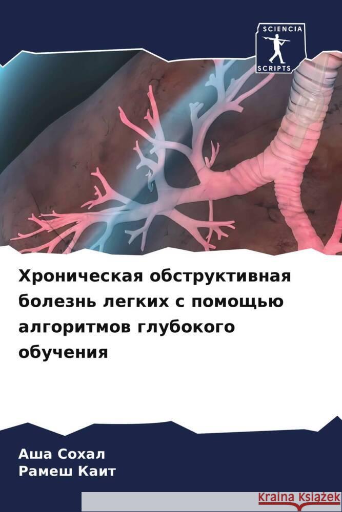 Хроническая обструктив&#  Сохал Р Каит 9786207258789 Sciencia Scripts - książka
