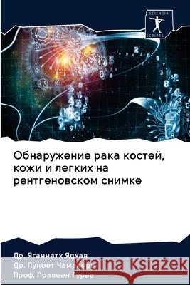 Обнаружение рака костей, Ядхав, 9786202834209 Sciencia Scripts - książka