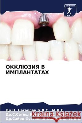 ОККЛЮЗИЯ В ИМПЛАНТАТАХ Б.Д.С., М.Д. 9786203948592 Sciencia Scripts - książka