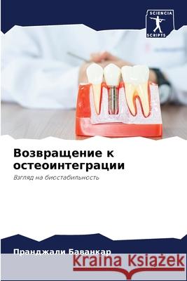 Возвращение к остеоинте& Баванl 9786204159140 Sciencia Scripts - książka